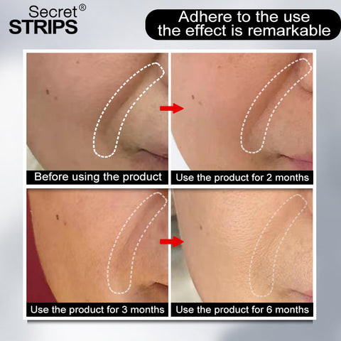 Magic Strips for Wrinkles – Anti-Aging Collagen Face Strips