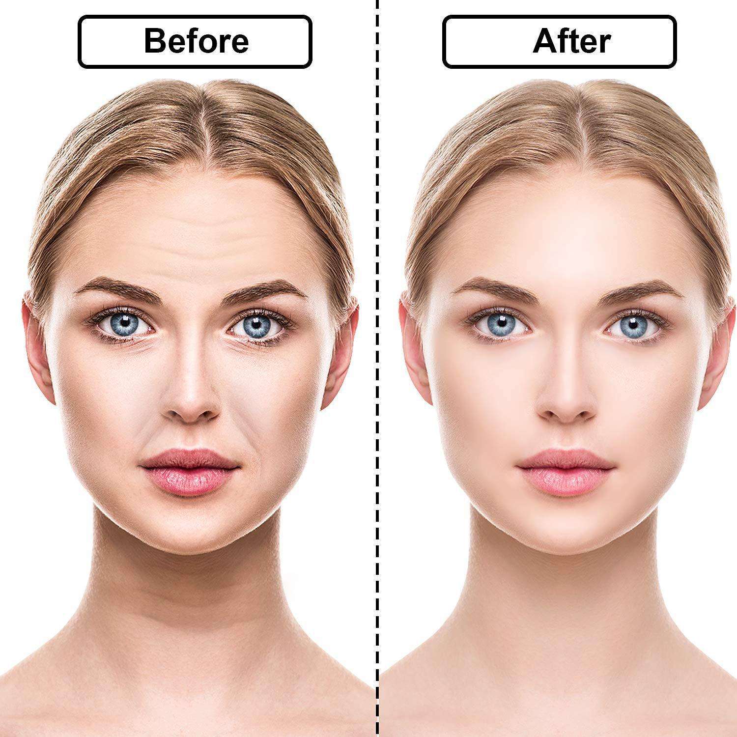 Reusable Facial Anti-Wrinkle Face Gel Pad